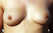 weibliche-brust